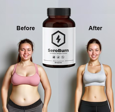 SeroBurn